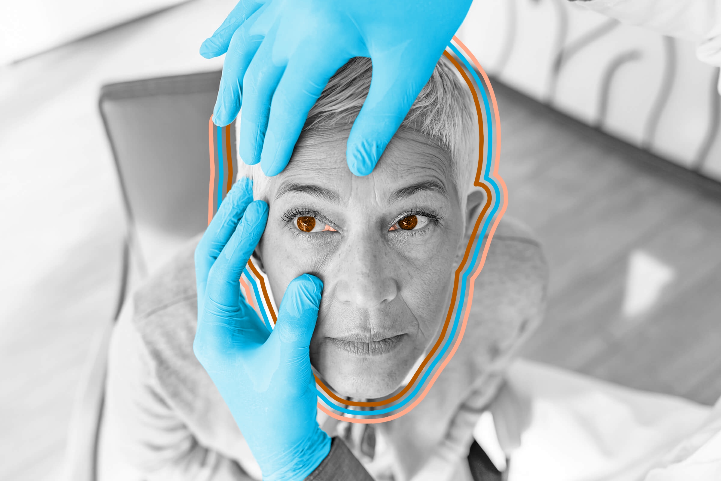 You can still see part of your third eyelid.