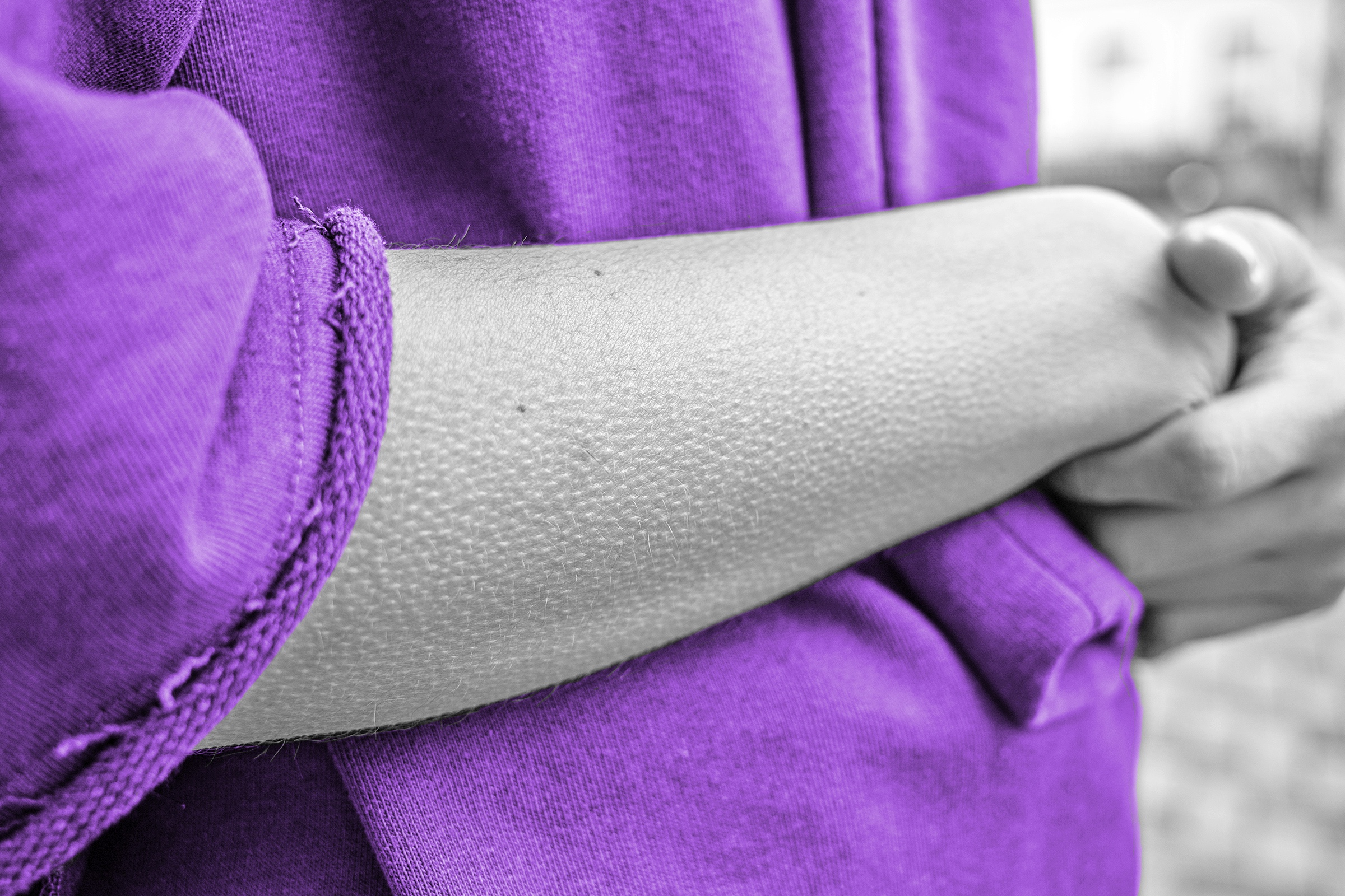 Woman's arm covered in goosebumps