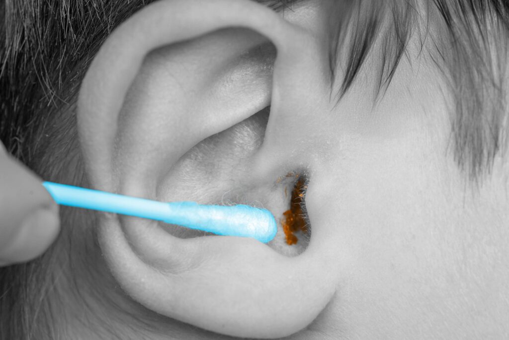 Digging in child's ear with cotton swab