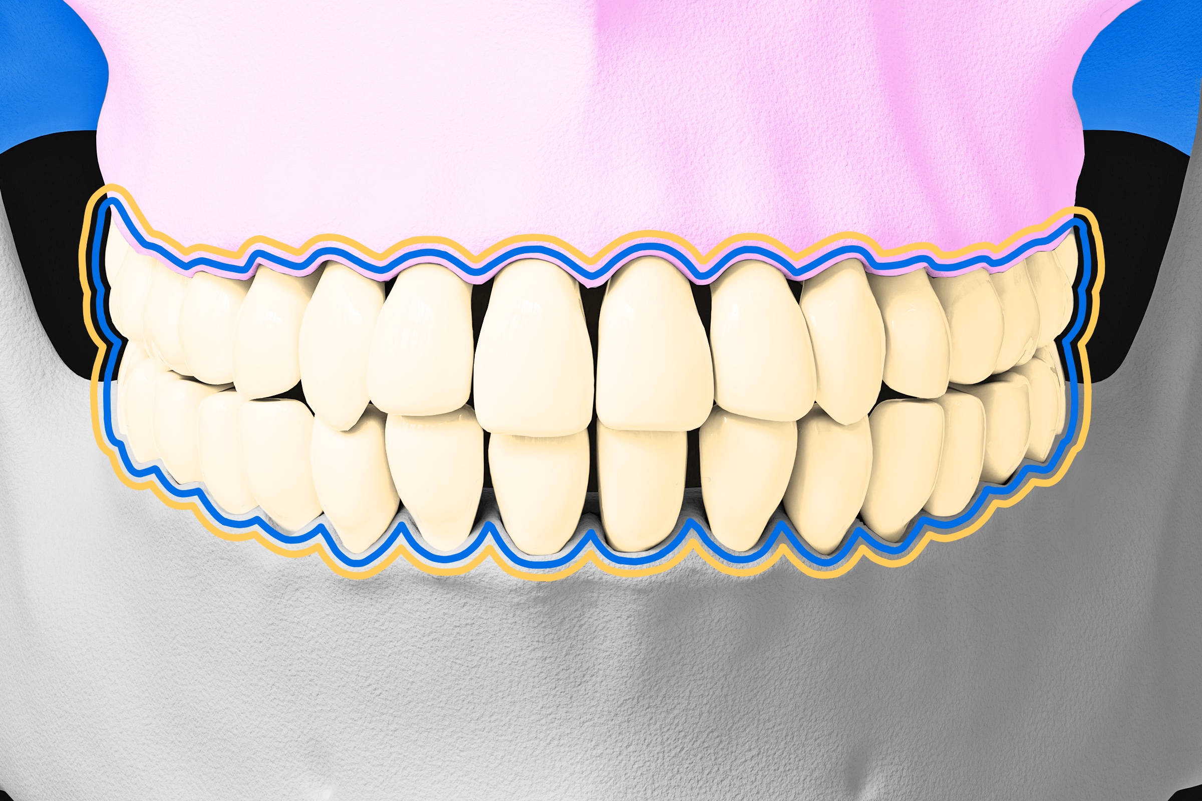 Humans have the potential for a third set of teeth.